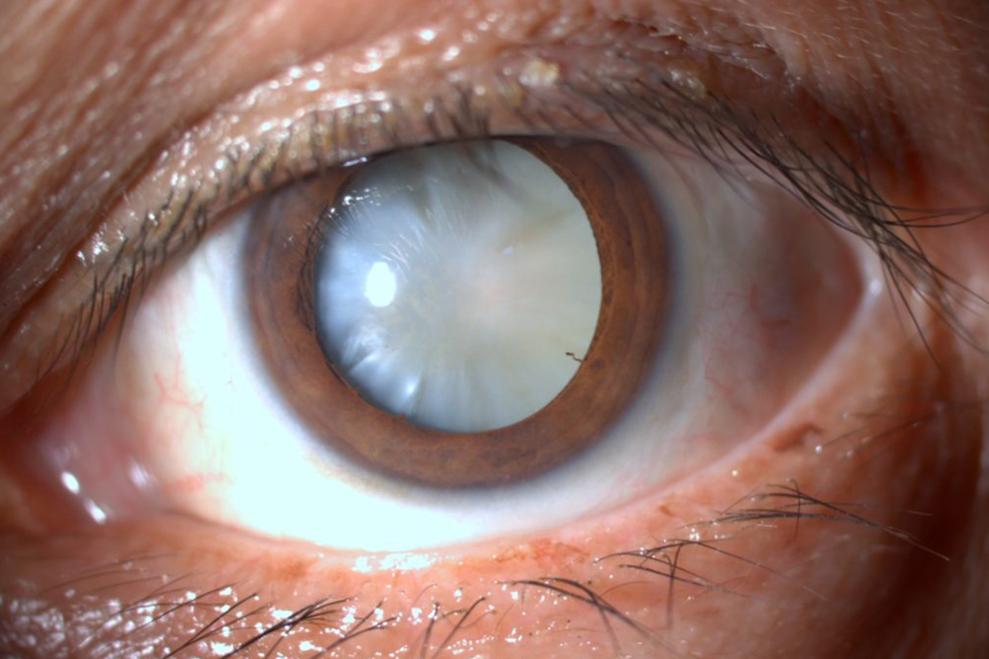 Cataratas